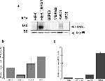 TRPA1 Antibody in Western Blot (WB)