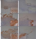 Complement Factor B Antibody in Immunohistochemistry (IHC)