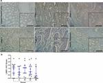 LIMK1 Antibody in Immunohistochemistry (IHC)