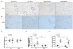 GFAP Antibody in Immunohistochemistry (IHC)