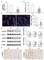 IFN gamma Antibody in Immunohistochemistry (IHC)