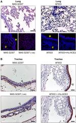 ACE2 Antibody in Immunohistochemistry (IHC)