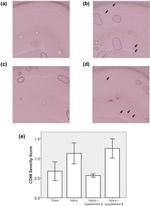 CD68 Antibody in Immunohistochemistry (IHC)