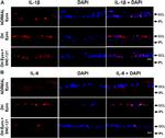 IL-6 Antibody in Immunohistochemistry (IHC)