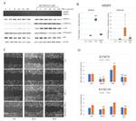 MMP14 Antibody in Western Blot (WB)