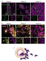 Cytokeratin Pan Antibody in Immunohistochemistry (IHC)