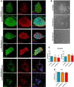 SSEA4 Antibody in Immunocytochemistry (ICC/IF)