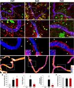 GFAP Antibody in Immunohistochemistry (IHC)