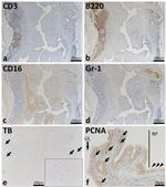 CD3 Antibody in Immunohistochemistry (IHC)