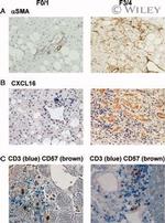 CD3 Antibody in Immunohistochemistry (IHC)