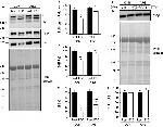 CaV1.1 Antibody in Western Blot (WB)