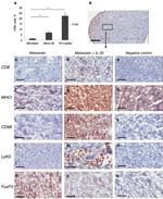 CD8a Antibody in Immunohistochemistry (IHC)