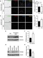 VPS4B Antibody in Immunohistochemistry (Paraffin) (IHC (P))