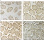 CD14 Antibody in Immunohistochemistry (IHC)