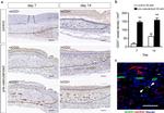 CD31 (PECAM-1) Antibody in Immunohistochemistry (IHC)