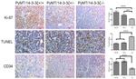 CD34 Antibody in Immunohistochemistry (IHC)