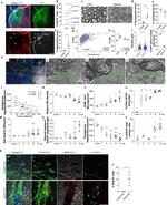 CD44 Antibody in Immunohistochemistry (IHC)