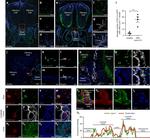 LYVE1 Antibody in Immunohistochemistry (IHC)