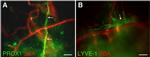 LYVE1 Antibody in Immunohistochemistry (IHC)