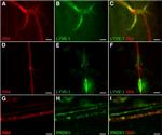 LYVE1 Antibody in Immunohistochemistry (IHC)