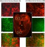 CD45 Antibody in Immunohistochemistry (IHC)