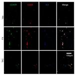 CD45R (B220) Antibody in Immunohistochemistry (IHC)