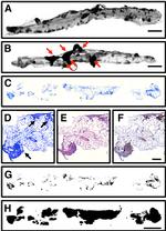 CD45 Antibody in Immunohistochemistry (IHC)