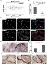 CD49f (Integrin alpha 6) Antibody in Flow Cytometry (Flow)