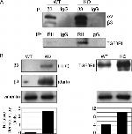 CD61 (Integrin beta 3) Antibody in Western Blot (WB)