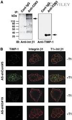 CD63 Antibody in Immunoprecipitation (IP)