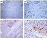 CD68 Antibody in Immunohistochemistry (IHC)