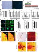 CD68 Antibody in Immunohistochemistry (IHC)