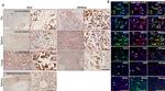 ACE2 Antibody in Immunohistochemistry (IHC)