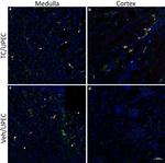 CD140b (PDGFRB) Antibody in Immunohistochemistry (IHC)