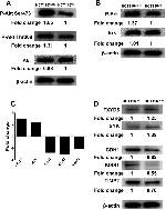 CD196 (CCR6) Antibody in Western Blot (WB)