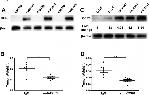 CD196 (CCR6) Antibody in Western Blot (WB)