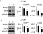 CD196 (CCR6) Antibody in Western Blot (WB)