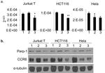 CD196 (CCR6) Antibody in Western Blot (WB)