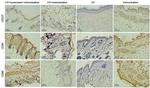 CD207 (Langerin) Antibody in Immunohistochemistry (IHC)