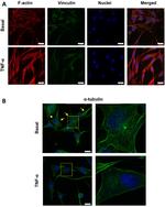 alpha Tubulin Antibody in Immunocytochemistry (ICC/IF)