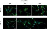 alpha Tubulin Antibody in Immunocytochemistry (ICC/IF)