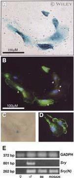 Acetyl-alpha Tubulin (Lys40) Antibody in Immunohistochemistry (IHC)