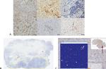 FOXP3 Antibody in Immunohistochemistry (IHC)