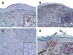 FOXP3 Antibody in Immunohistochemistry (IHC)