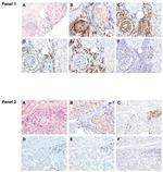 FOXP3 Antibody in Immunohistochemistry (IHC)