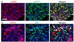 p21 Antibody in Immunocytochemistry (ICC/IF)