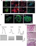 Alpha-Smooth Muscle Actin Antibody in Immunohistochemistry (IHC)