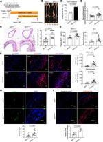 Galectin 3 Antibody in Immunocytochemistry, Immunohistochemistry (ICC/IF, IHC)