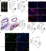 Galectin 3 Antibody in Immunocytochemistry, Immunohistochemistry (ICC/IF, IHC)