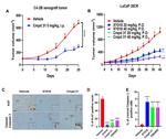 Ki-67 Antibody in Immunohistochemistry (IHC)